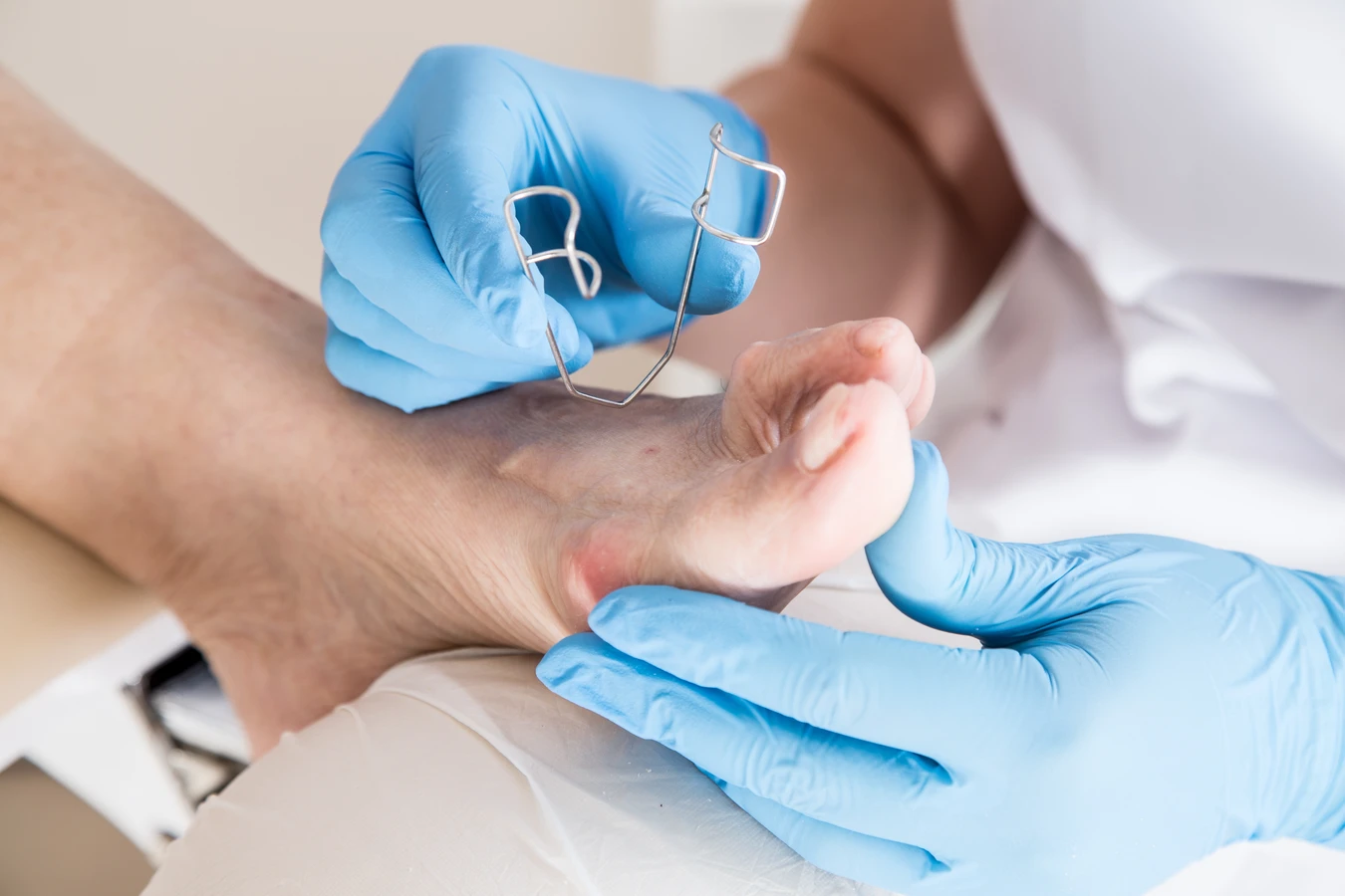 Podolog radzi - jak przygotować stopy na wiosnę