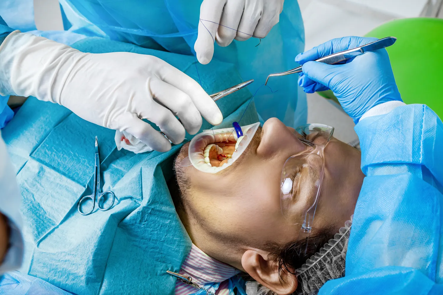 Jaka e recepta najlepsza?