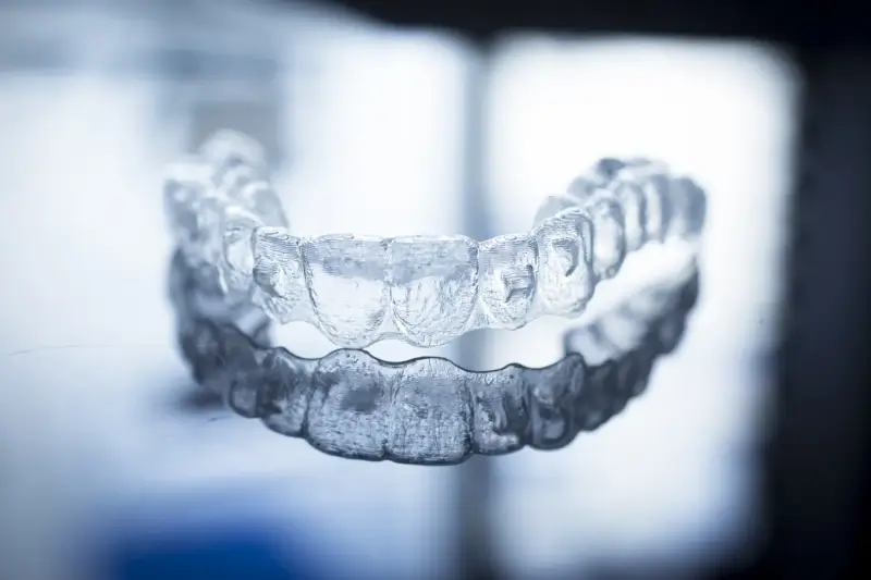 Nakładki Invisalign czy warto?