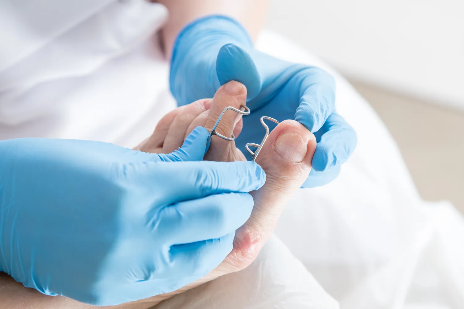 Podologia – czym jest i kiedy warto udać się do podologa?