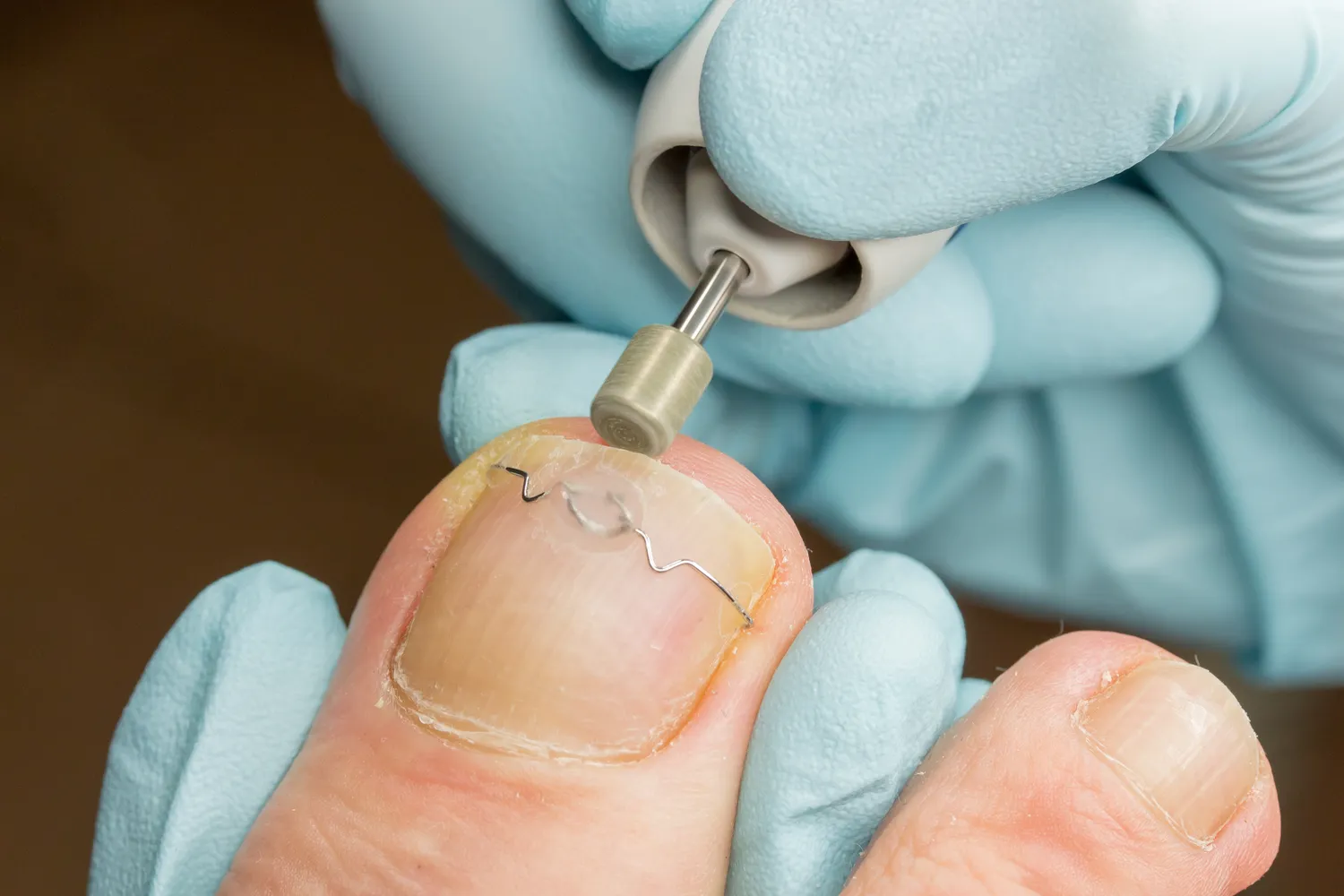  Kompleksowy przewodnik po podologii - co trzeba o niej wiedzieć?