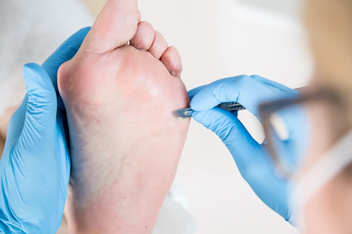 Pedicure leczniczy - czym jest i co warto wiedzieć na jego temat?